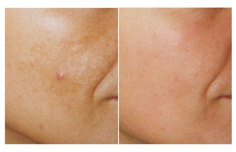 Elisabetta Fabiani-34