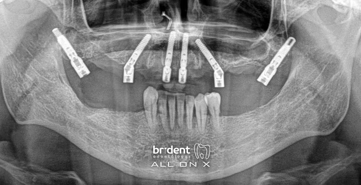 Guillermo Moreno Fragoso-32
