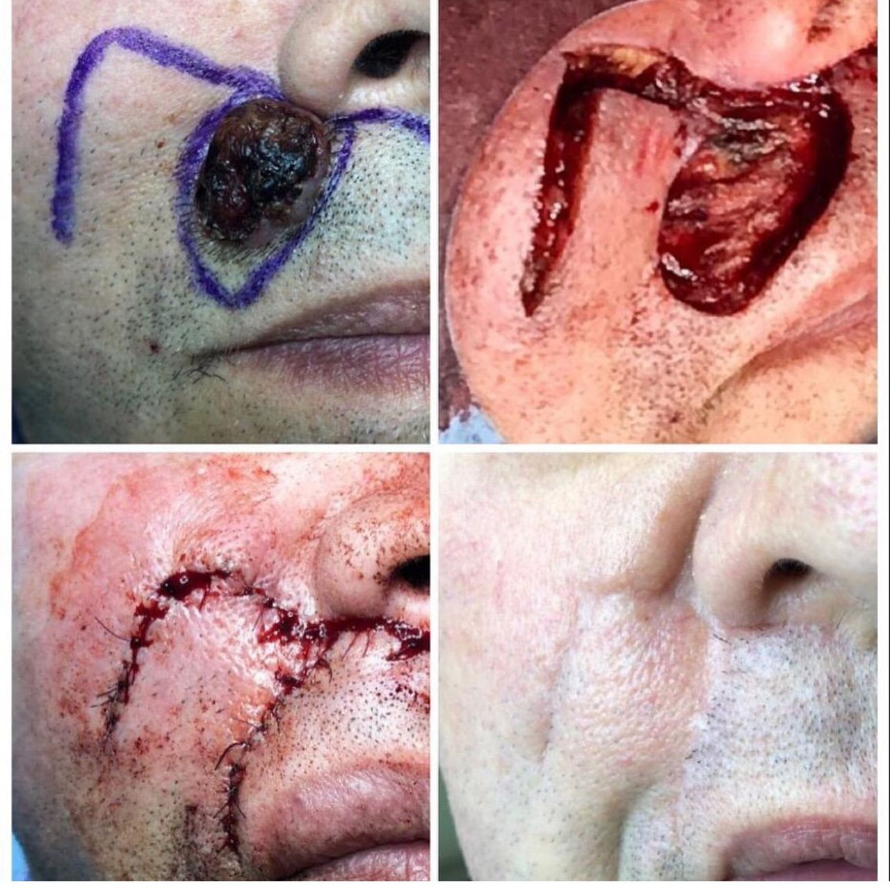 Angelo De Cataldis-4