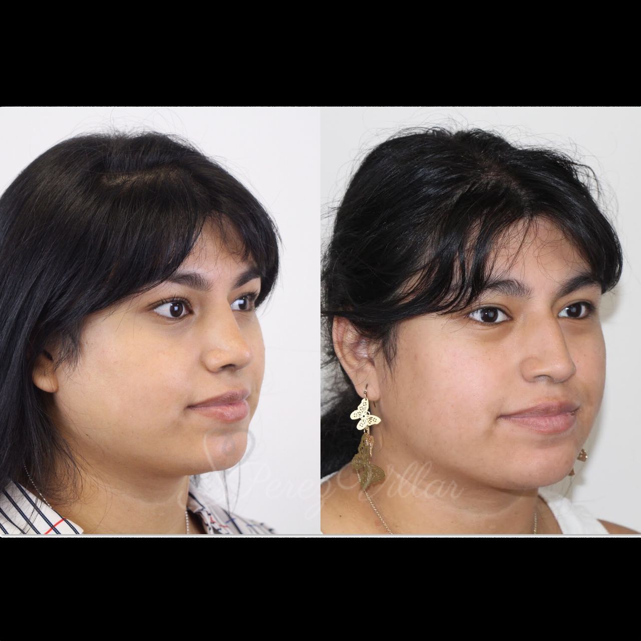 Alvaro Perez Villar-1