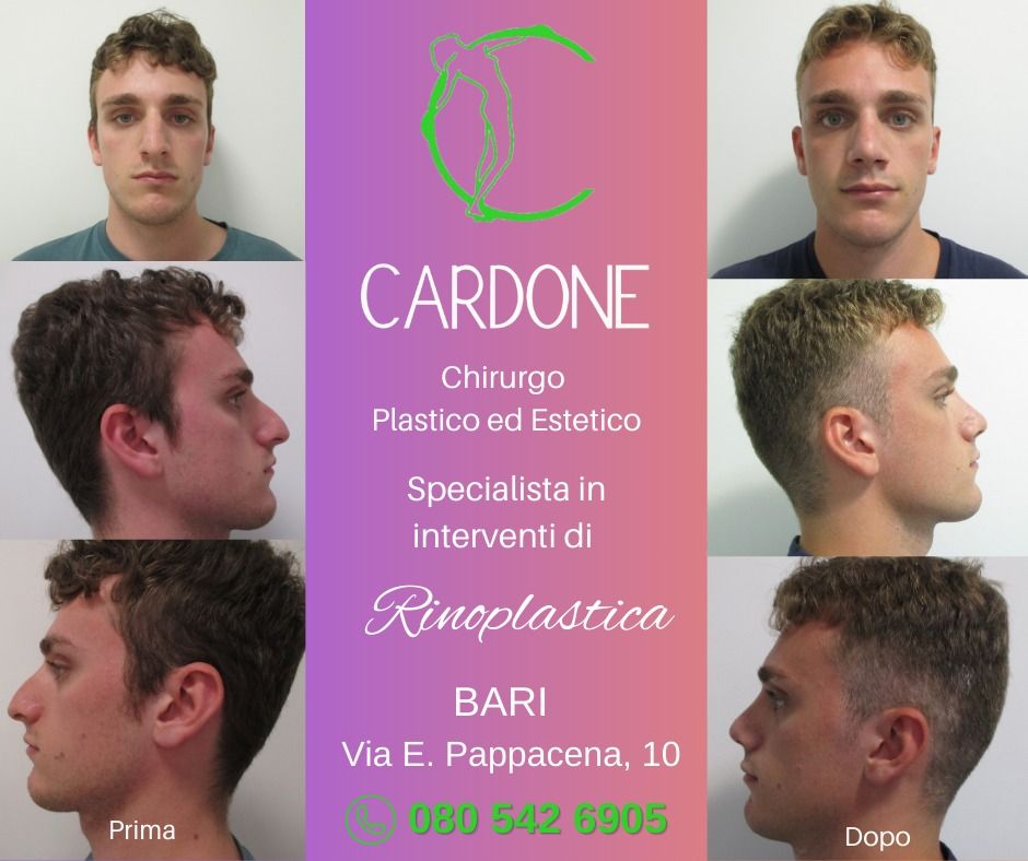 Patrizio Cardone-3