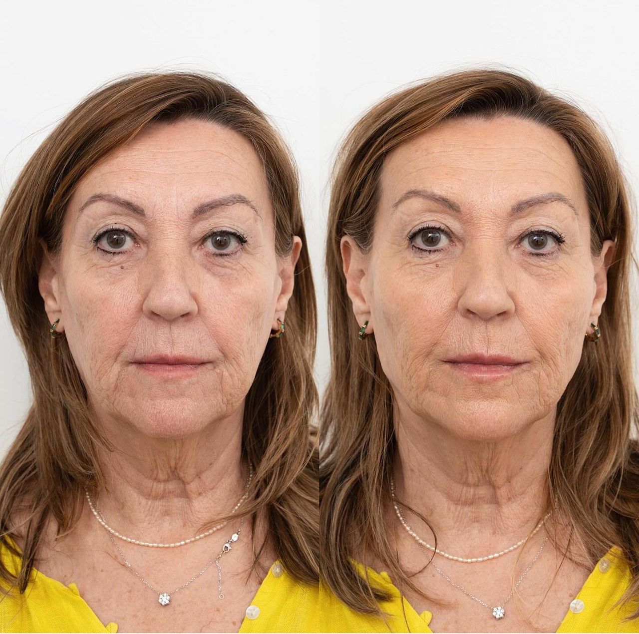 Raquel Moreno Pentinel-61