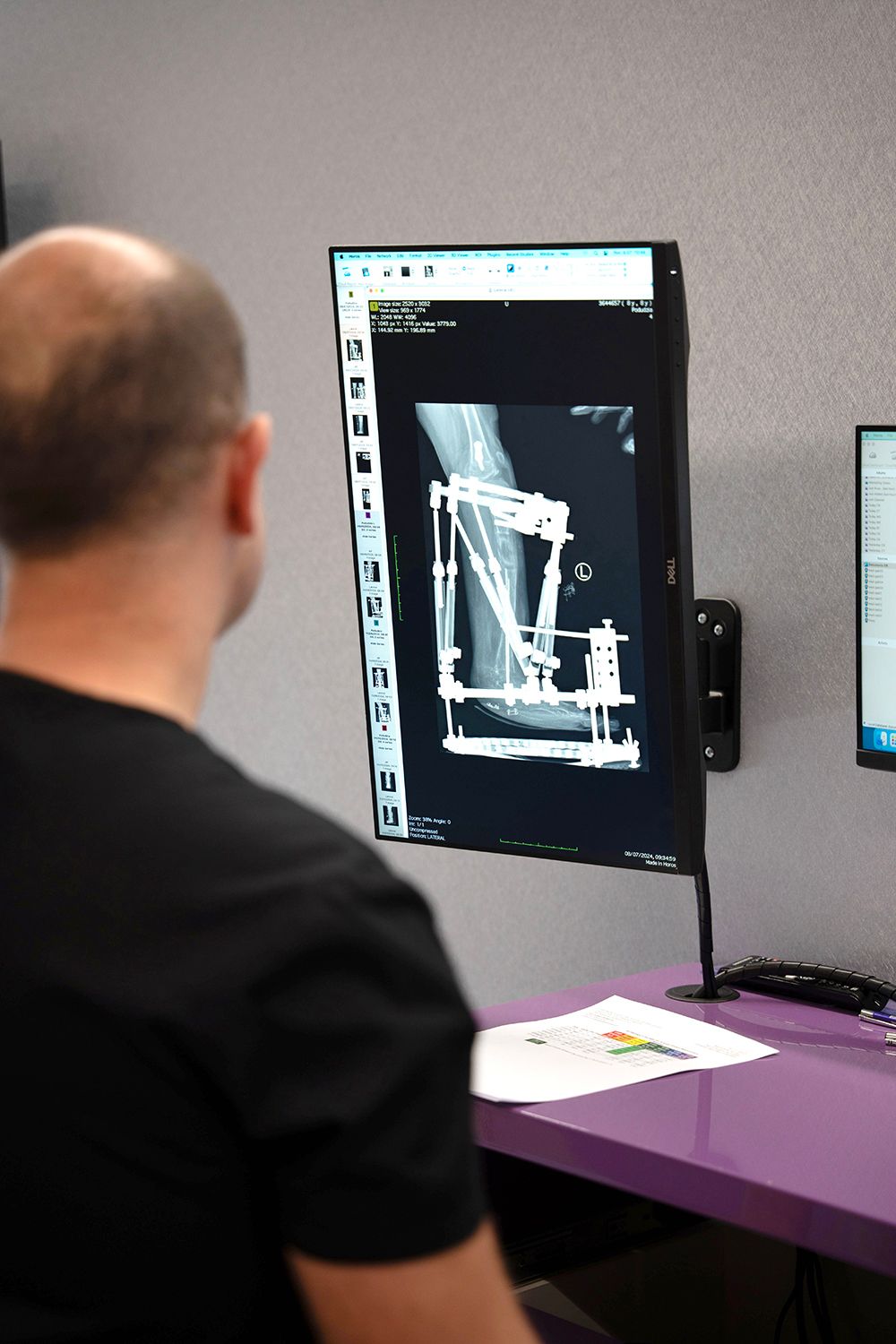 Tomasz Albrewczyński-2