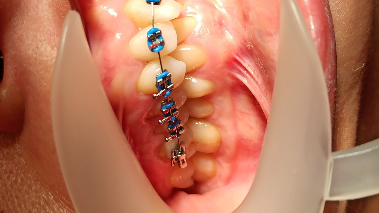 Elżbieta Zgłobicka-1