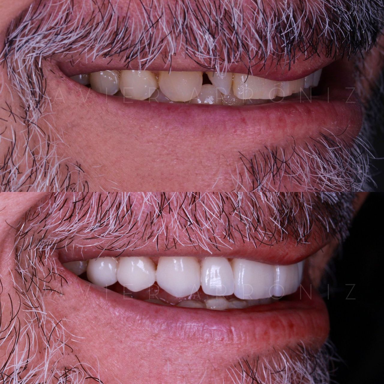 Javier Arroniz Gallego-1