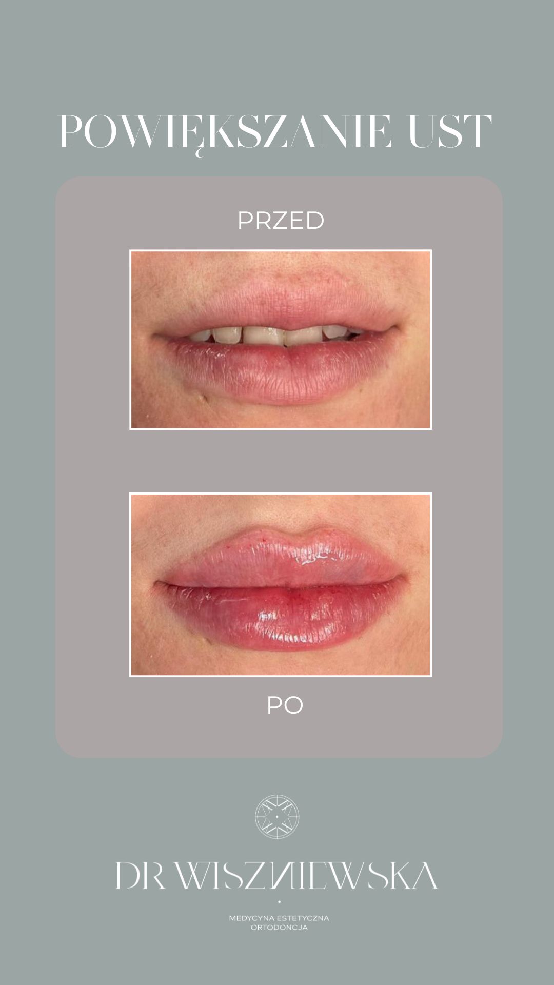 Beata Gibas Wiszniewska-18