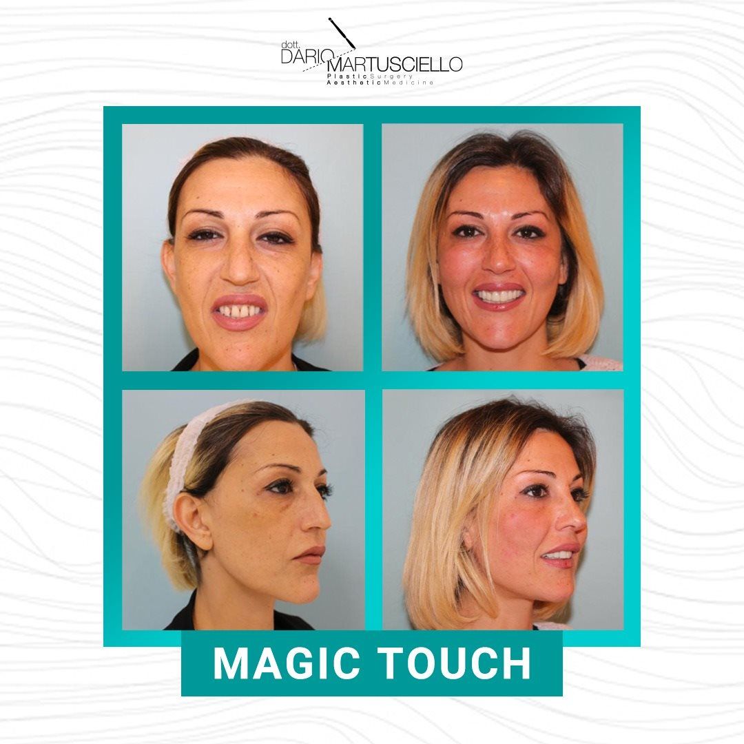 Dario Martusciello-4