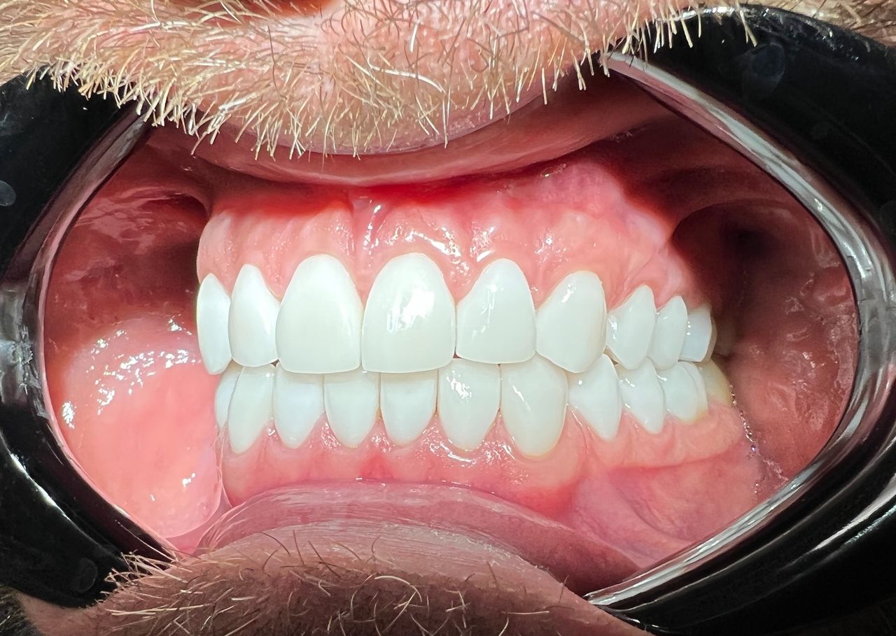 Małgorzata Protasewicz-Nowicka-20