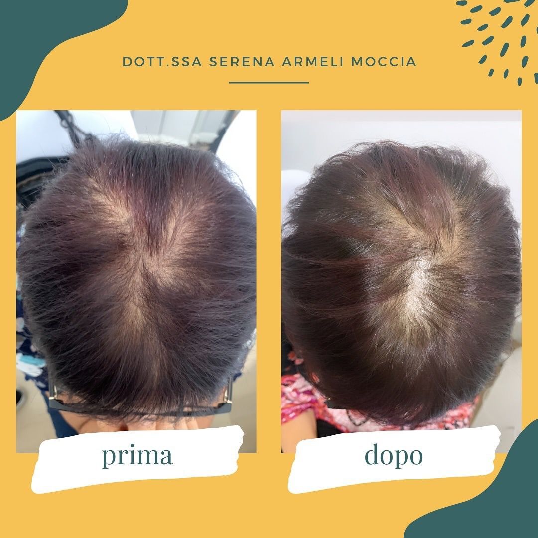 Serena Armeli Moccia-8