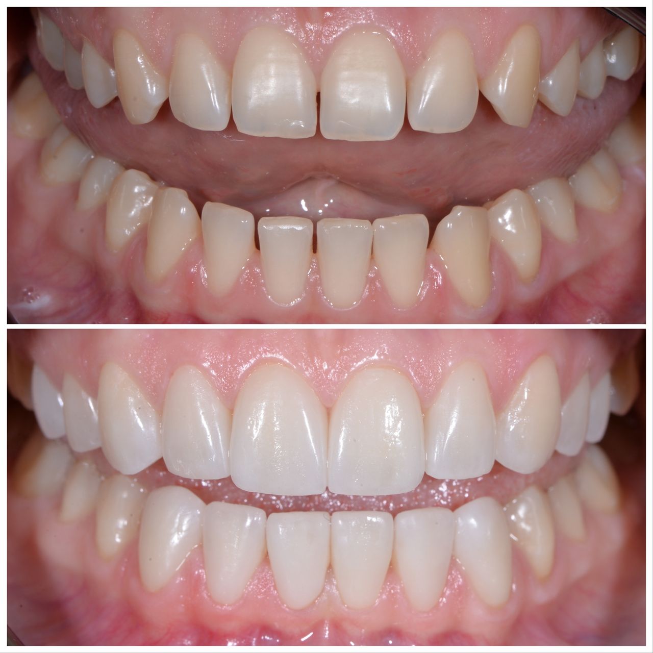 Martin Bartoszcze-31