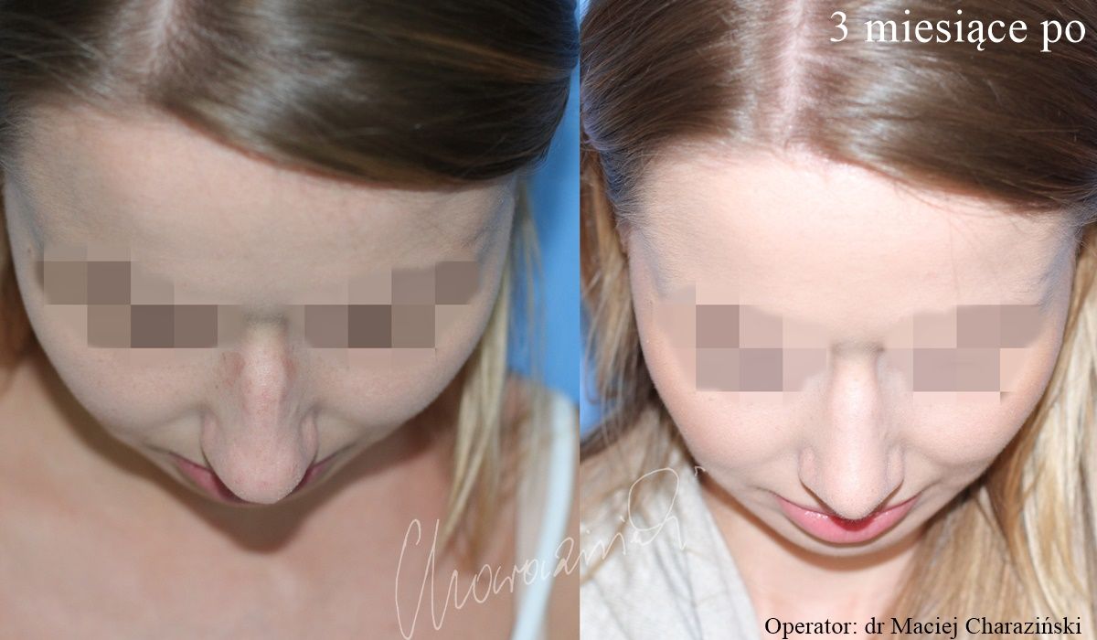 Maciej Charaziński-68