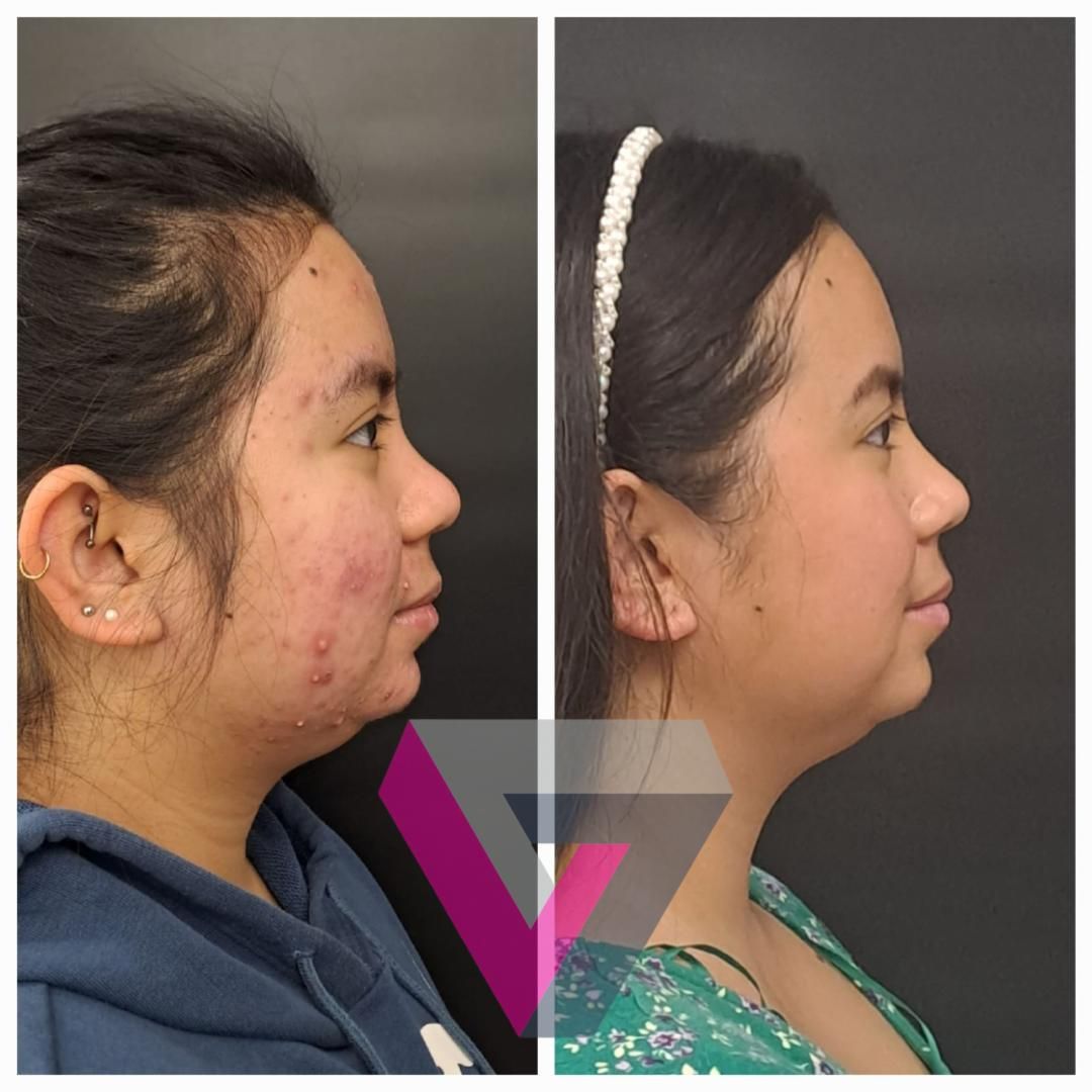 Victoria Trasmonte-112