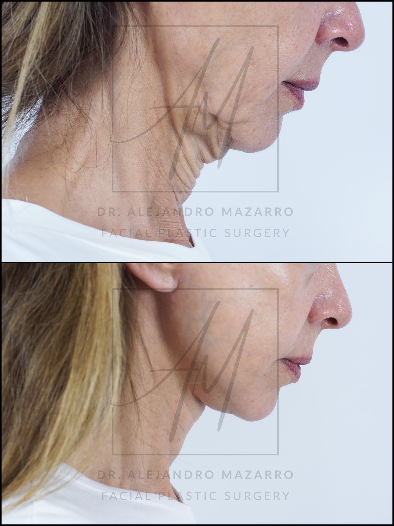 Alejandro Mazarro Campos-13