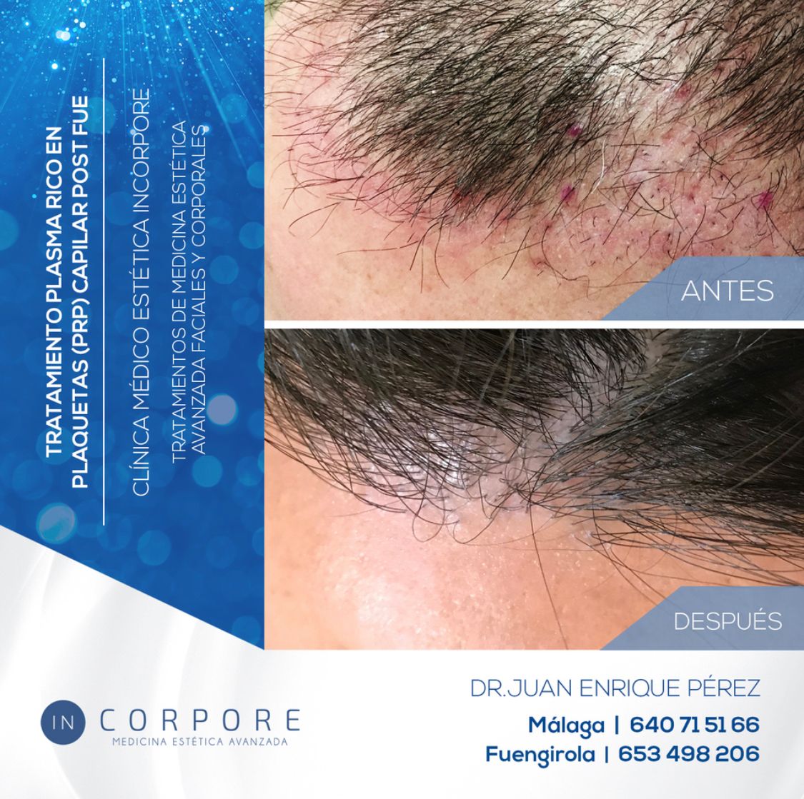 Juan Enrique Pérez Enríquez-70