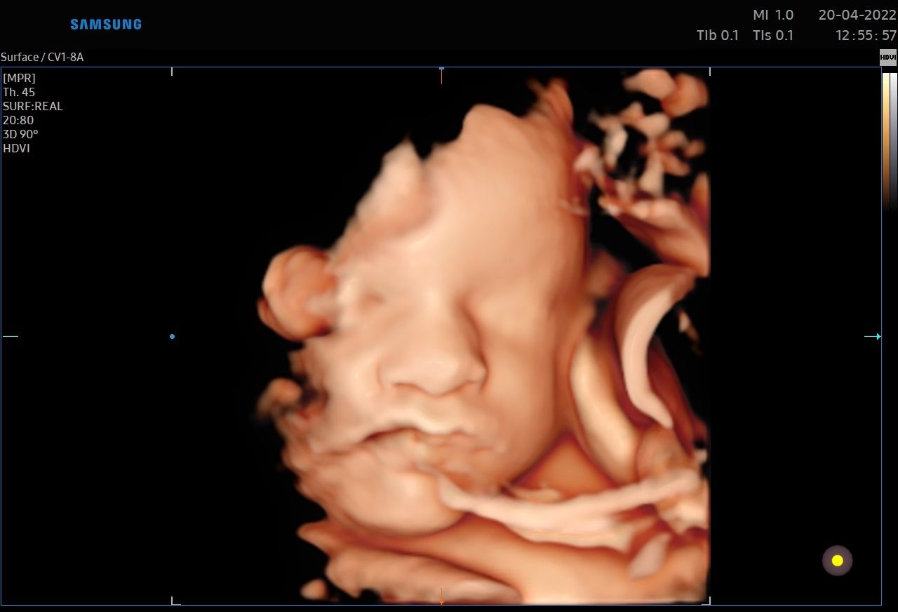 Valentina Conserva-9