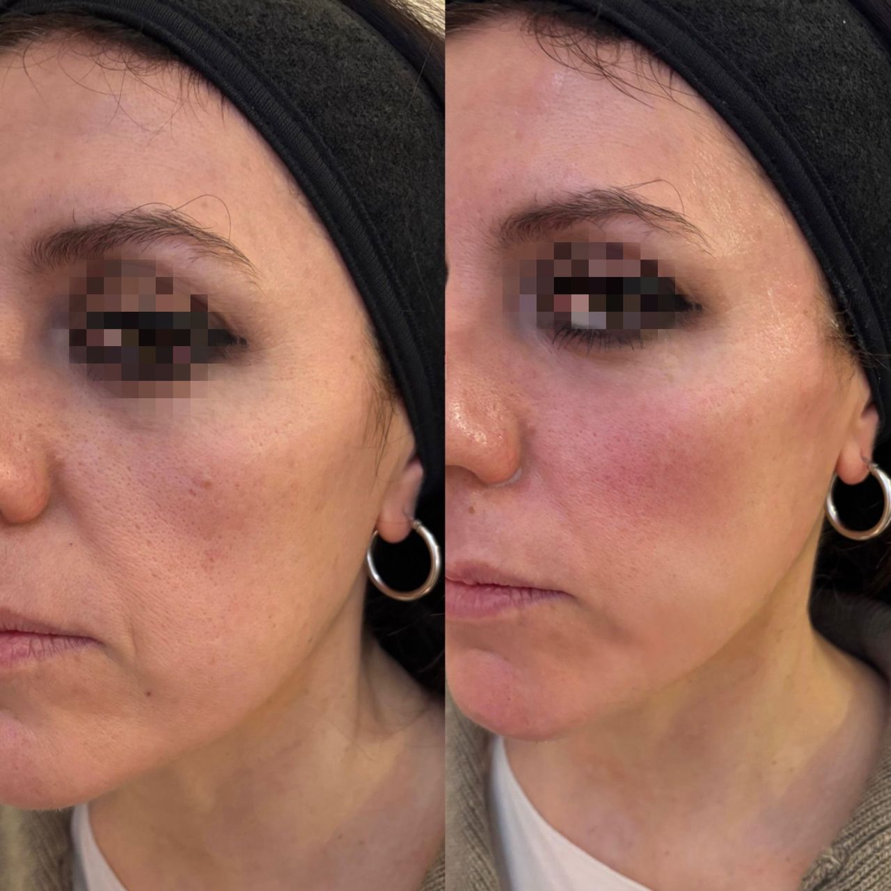 Denise Coniglio-16