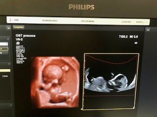 Domenico D'assisi-13