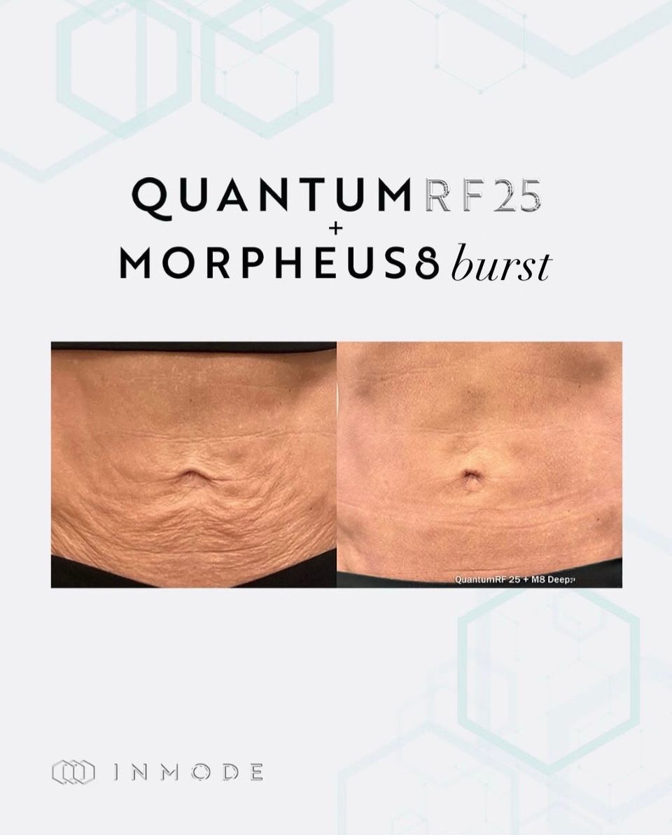 Raffaele Del Prete-21