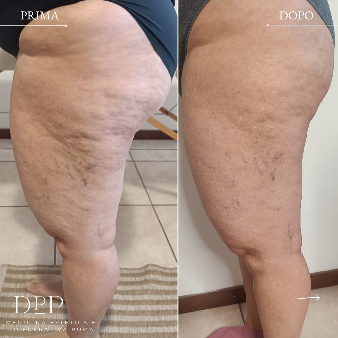 Davide Prosperi Porta-11