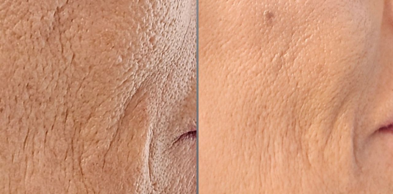 Rosalba Herrero Zerpa-452