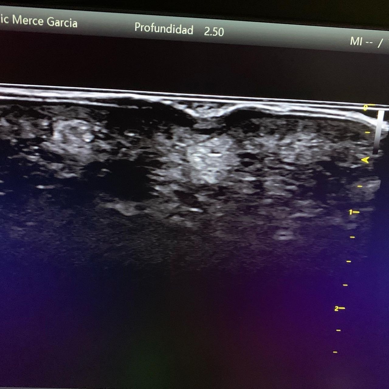 Mercè Garcia Lizandra-7