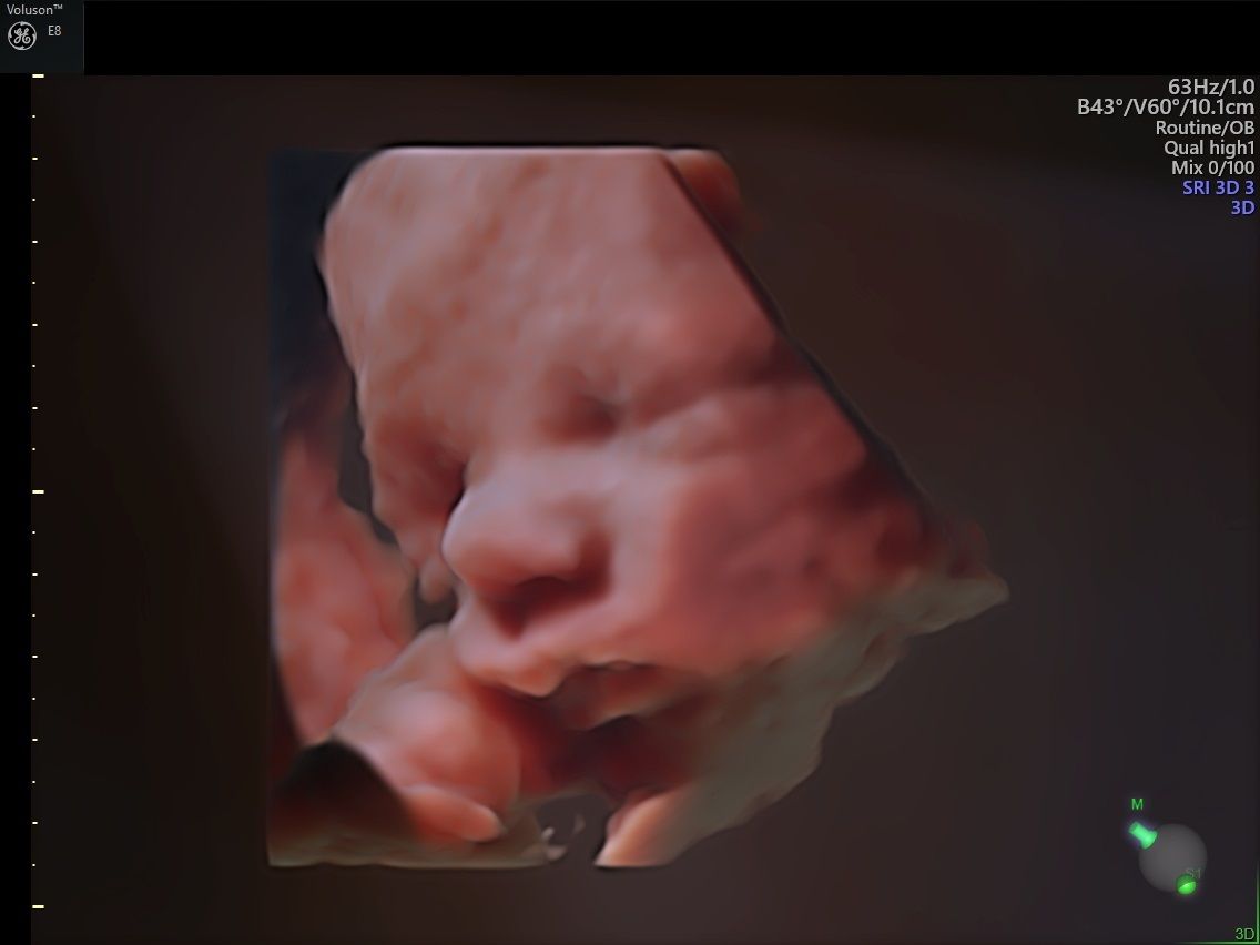 Sebastian Ławrynowicz-2