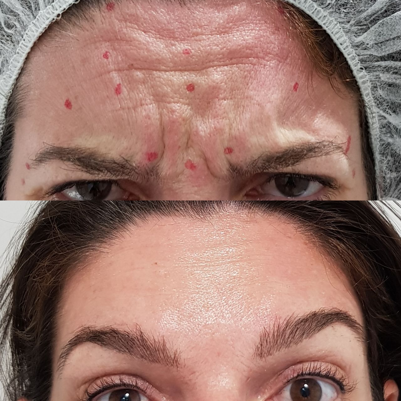 Rosalba Herrero Zerpa-308