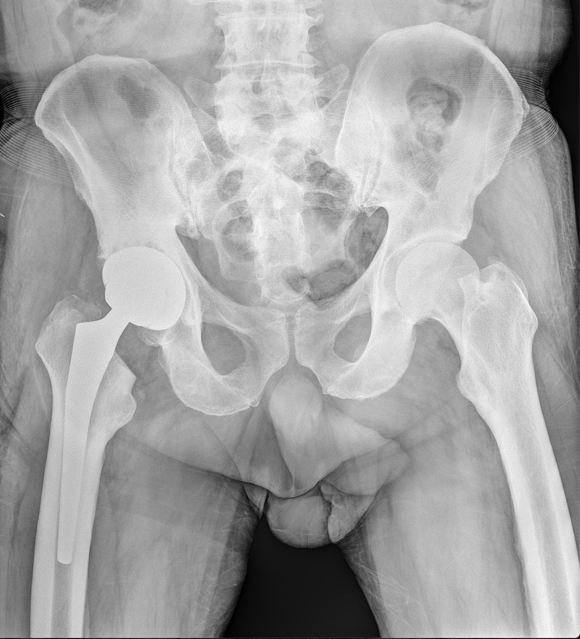 Claudio Lacagnina-10