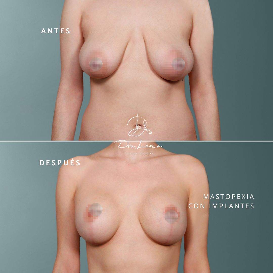 Concepción Lorca García-5