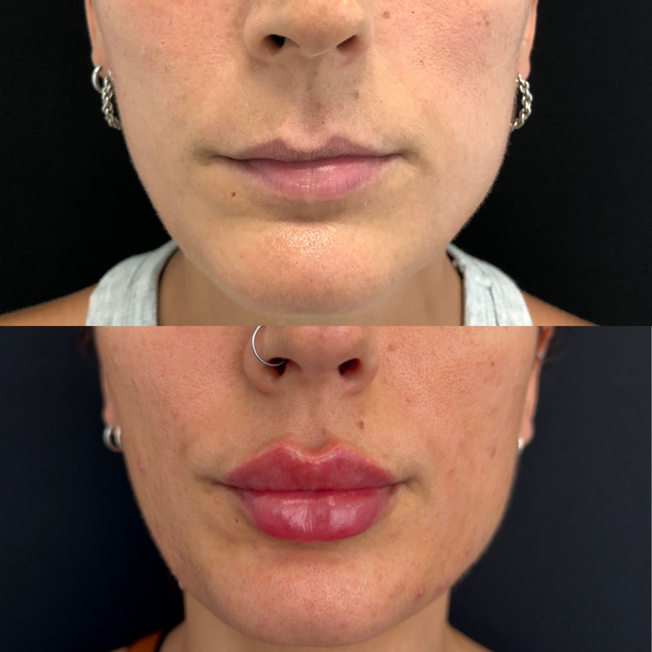 Raffaele Del Prete-1