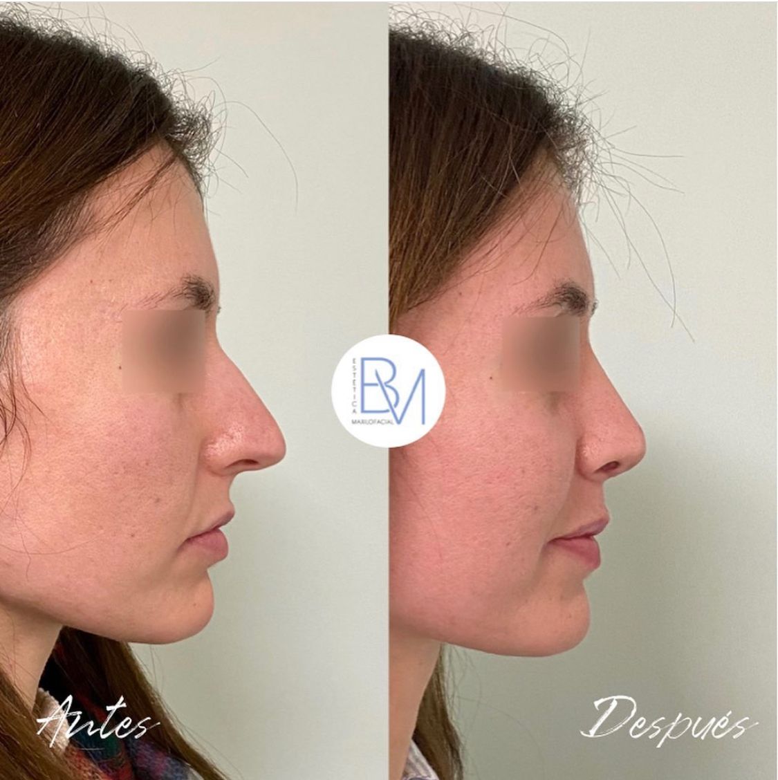 Beatriz Moralejo-105