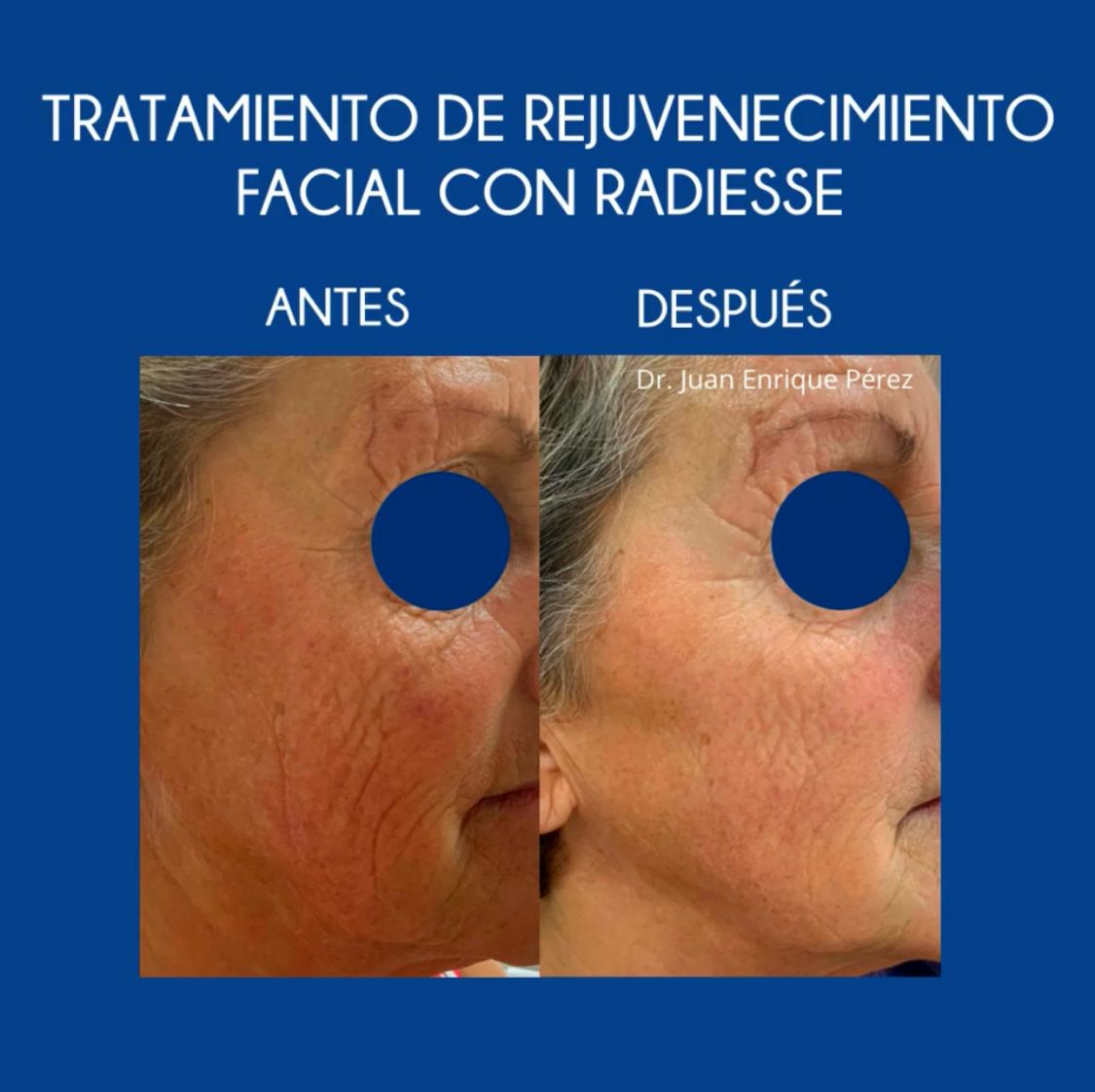 Juan Enrique Pérez Enríquez-11