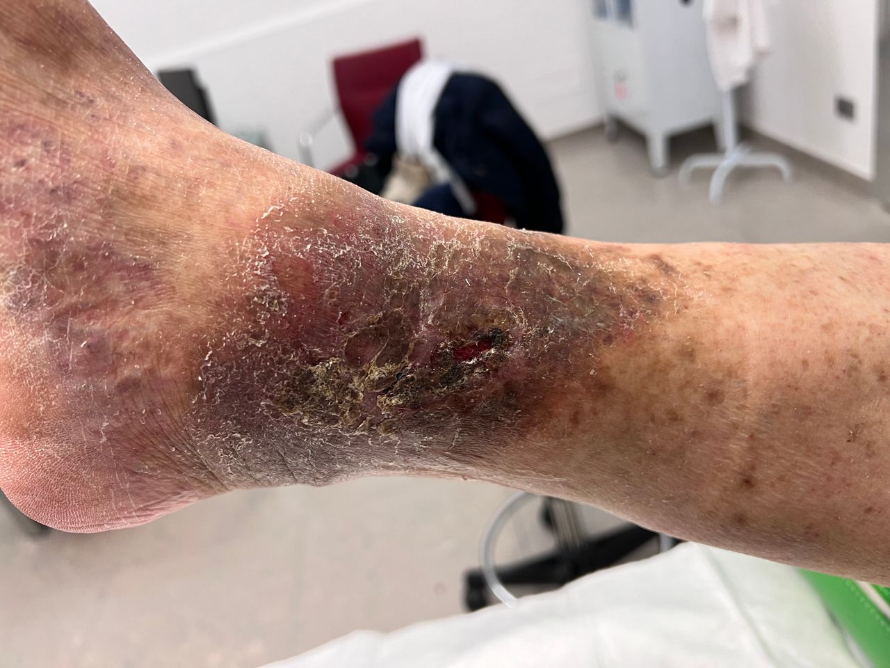 Luciano Allegretti-23