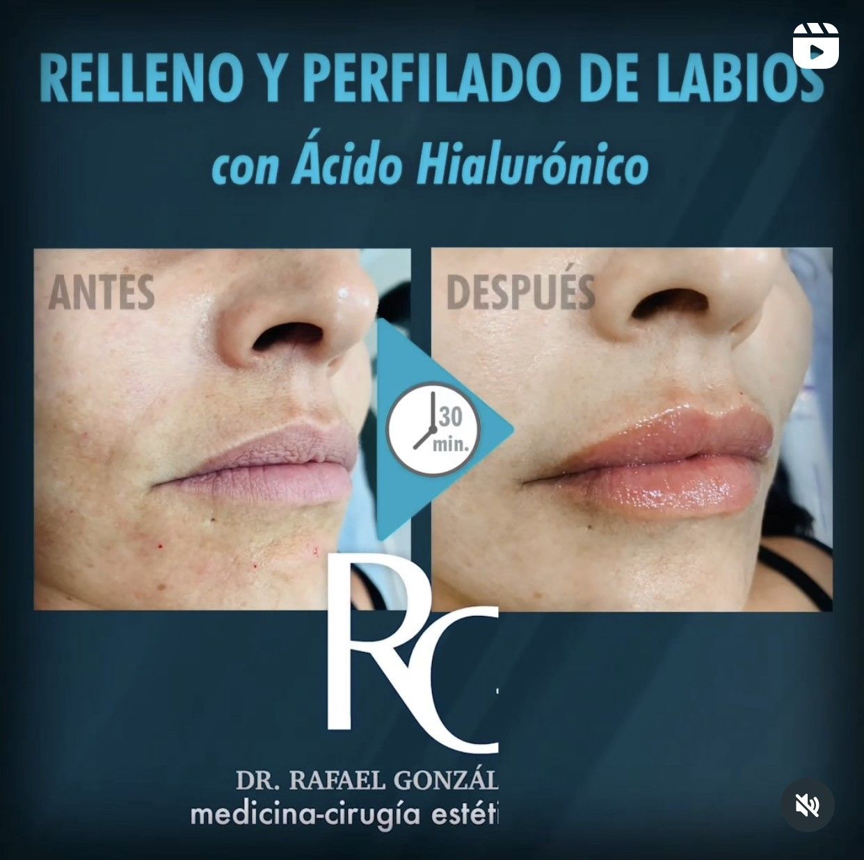 Rafael Gonzalez Oñate-3