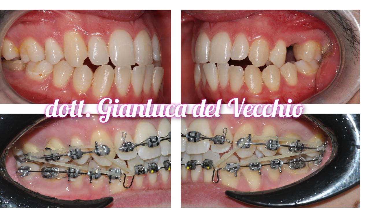 Gianluca Del Vecchio-69