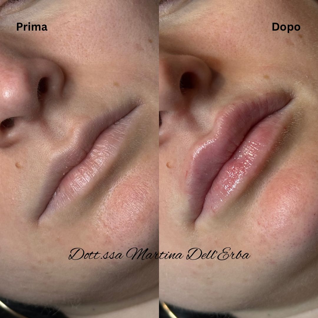 Martina Dell'erba-17