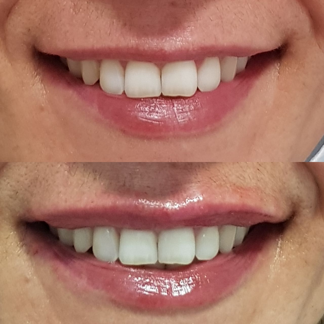 Rosalba Herrero Zerpa-275