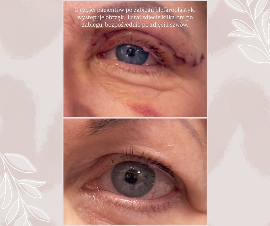 Piotr Florczuk-Dąbek-8