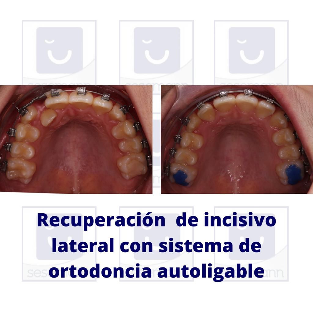 Paula Cano Carrillo-121