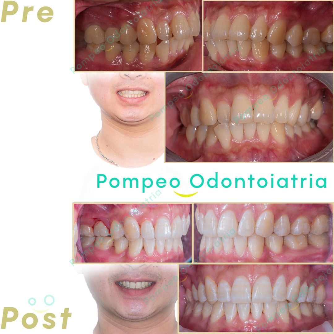 Enrico Maria Pompeo-1