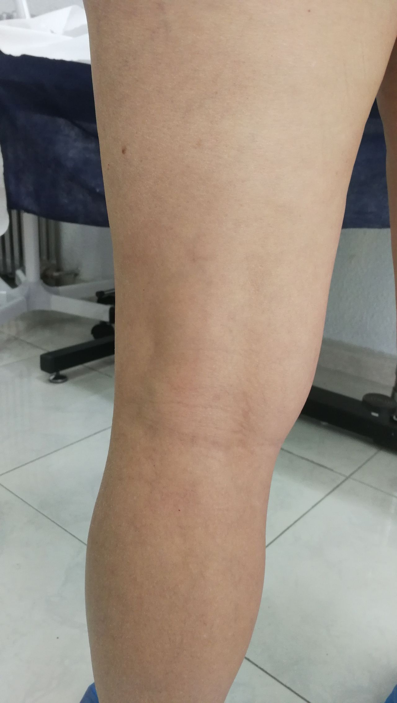 Jose Luis Velasco Soria-3