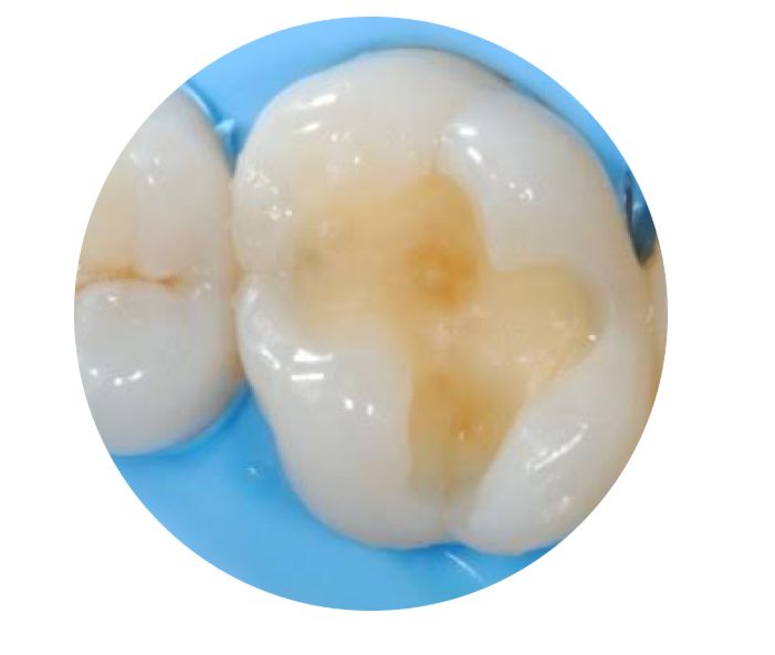 Salvatore Cangiano-1