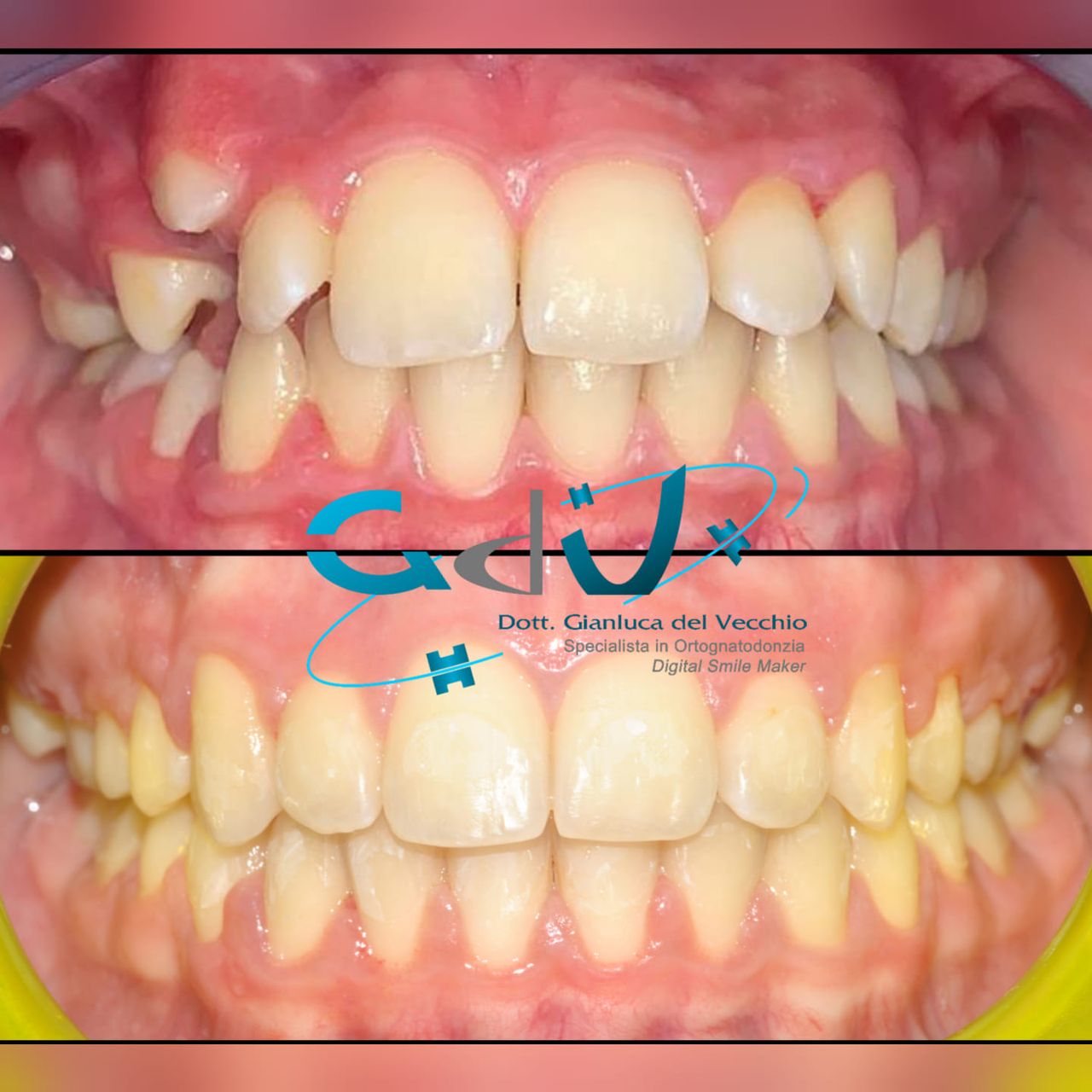 Gianluca Del Vecchio-142