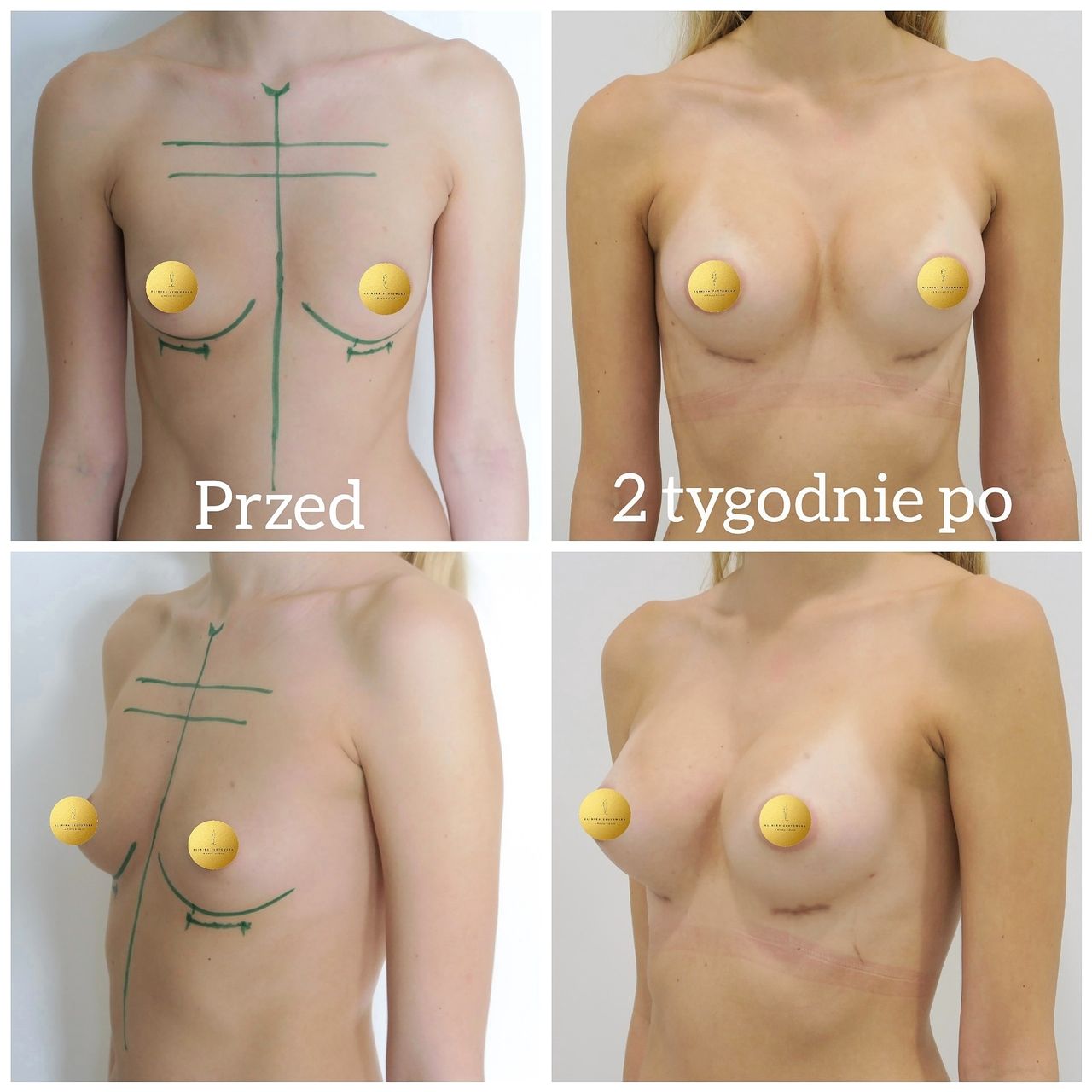 Krzysztof Biegański-16