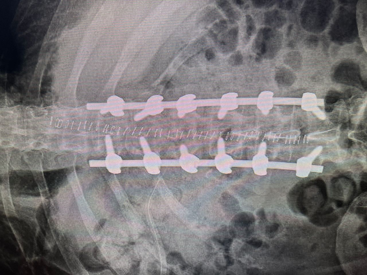 Federico Rodriguez De Tembleque Aguilar-0