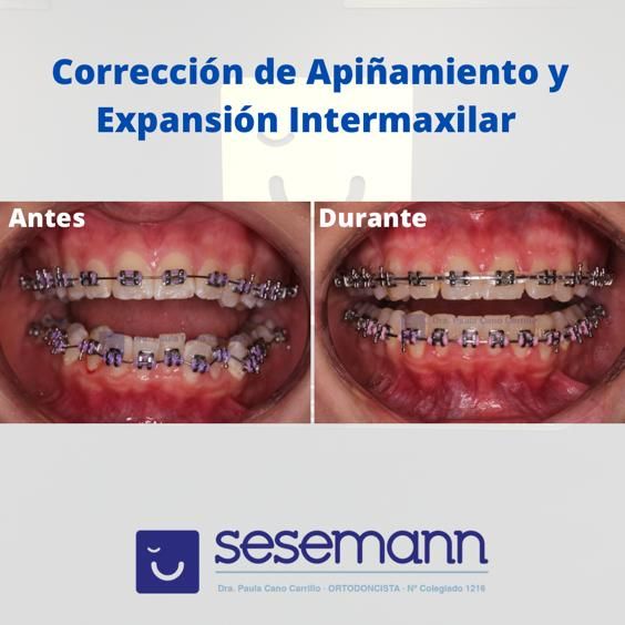 Paula Cano Carrillo-33