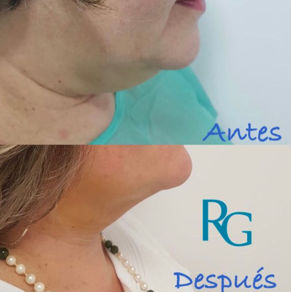 Rafael Gonzalez Oñate-6