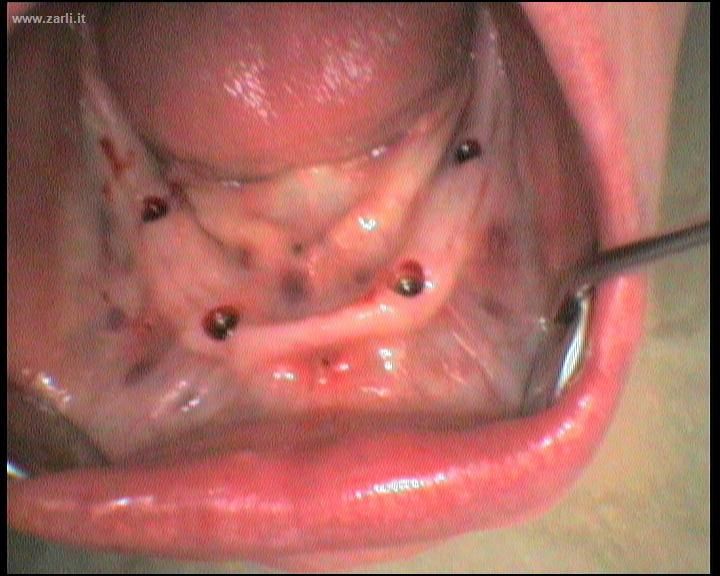 Francesco Dell'andrea-7