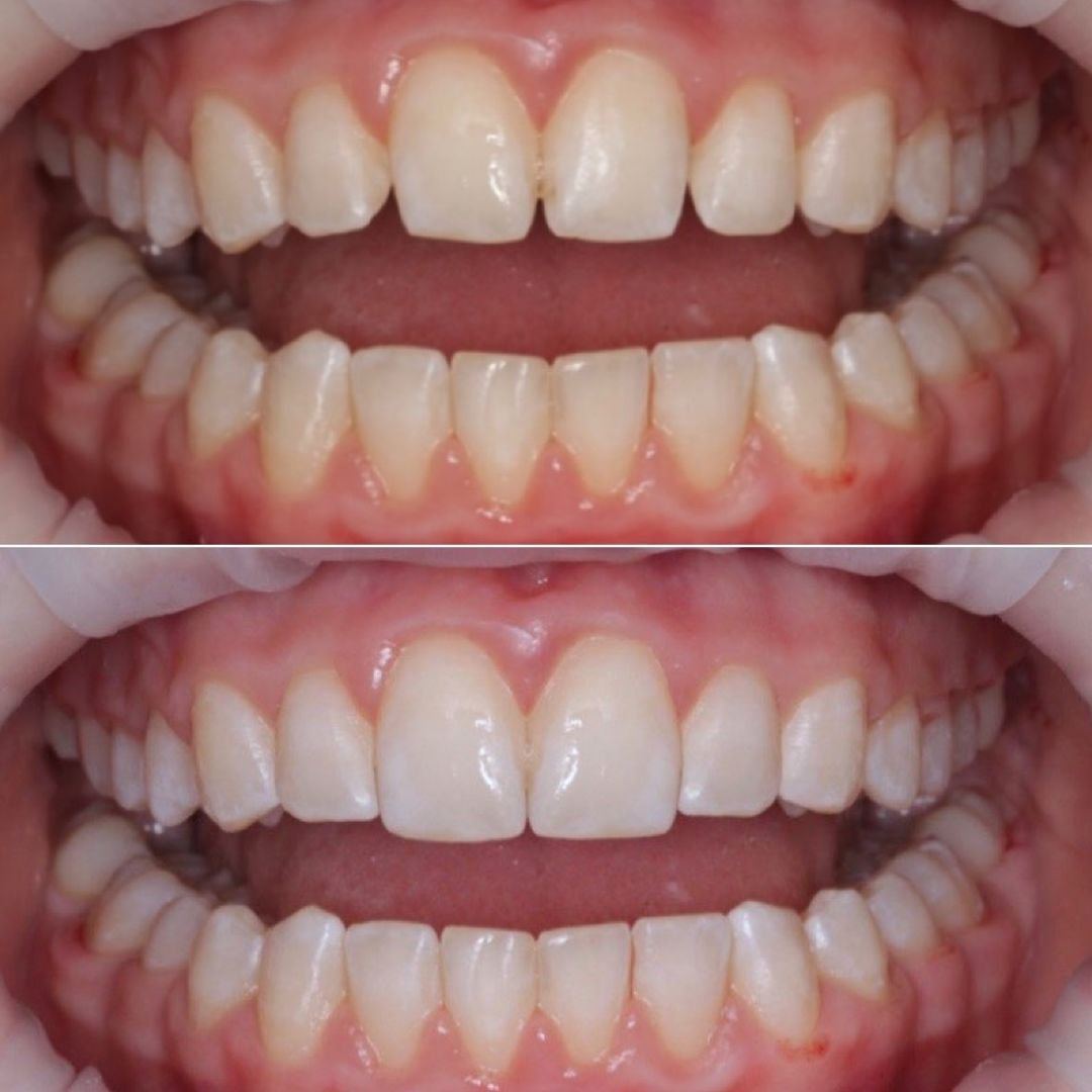 Valeriia Danyliuk-14