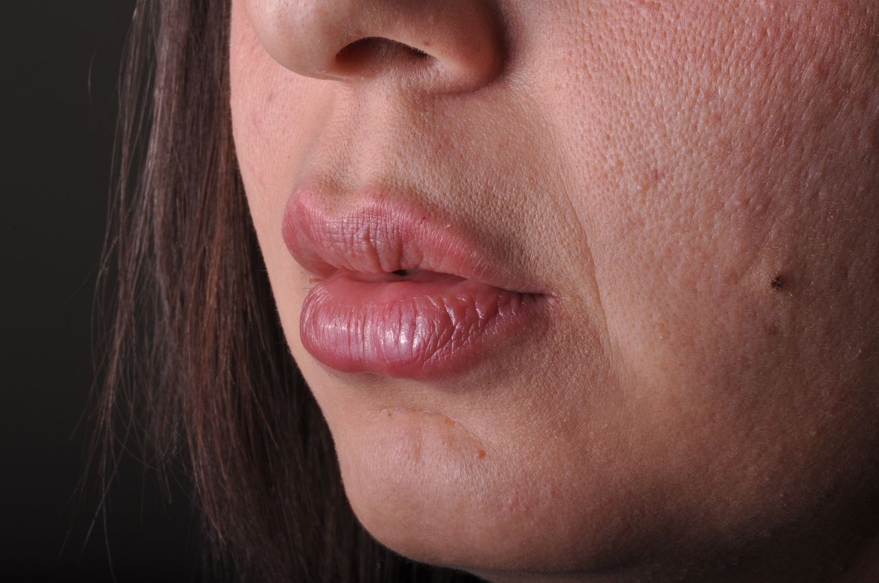 Alberto Alessandri-0